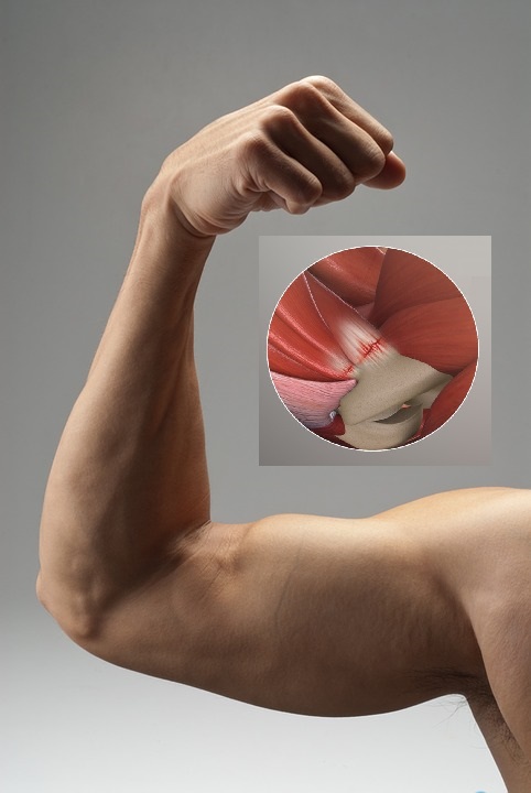 biceps